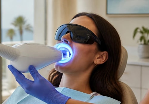 Exploring Teeth Whitening Options in San Diego